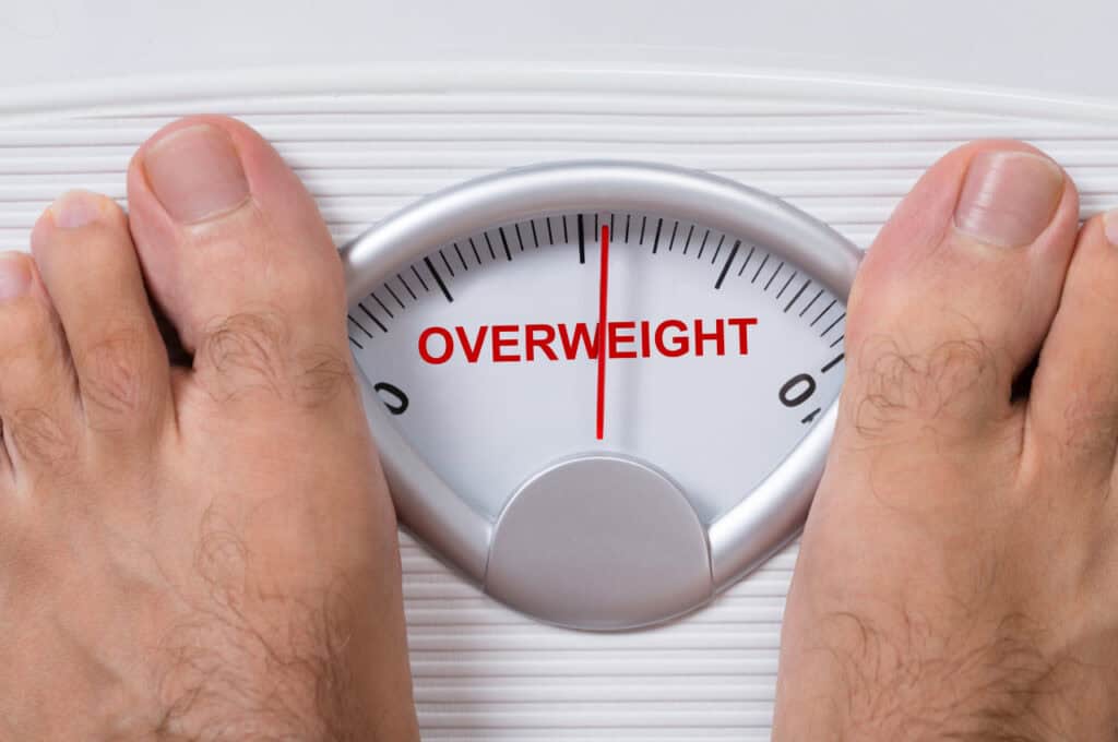 overweight cause gynecomastia
